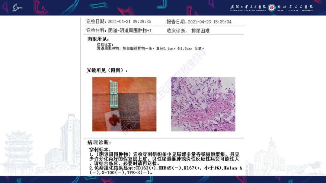 影像PPT - 【PPT】尿道原发透明细胞腺癌影像诊断-7