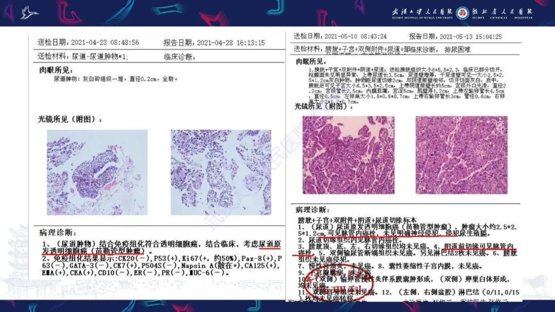 影像PPT - 【PPT】尿道原发透明细胞腺癌影像诊断-8