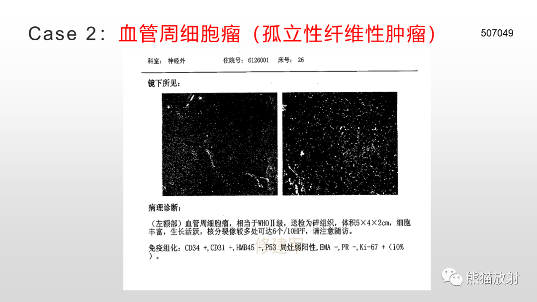 影像PPT - 【PPT】颅内孤立性纤维性肿瘤2例MR-20