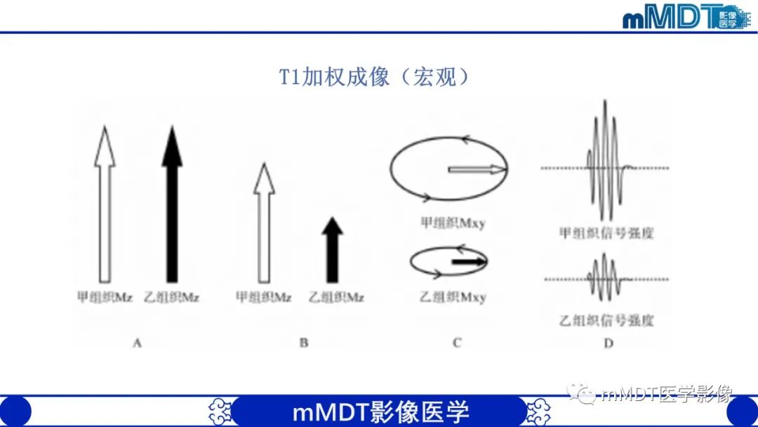 影像PPT - 【PPT】颅内呈短T1信号病变的概述及鉴别诊断-9