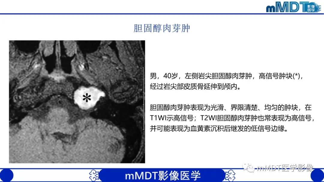 影像PPT - 【PPT】颅内呈短T1信号病变的概述及鉴别诊断-52