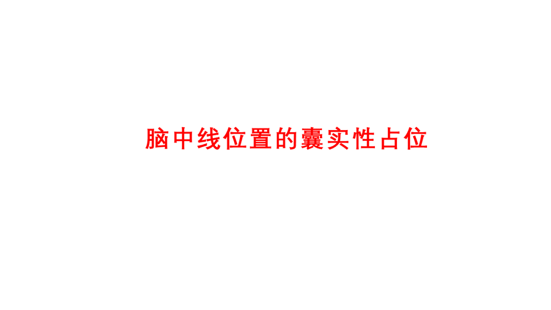 影像PPT - 【病例】侧脑室混合性生殖细胞瘤 VS 松果体畸胎瘤MR-34
