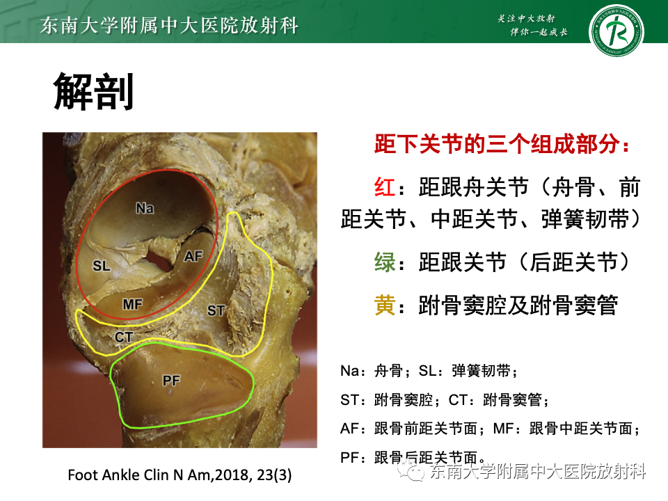 影像PPT - 【PPT】跗骨窦综合征-6