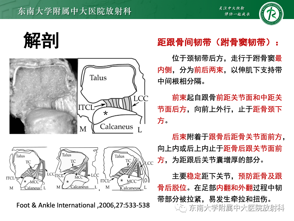 影像PPT - 【PPT】跗骨窦综合征-13
