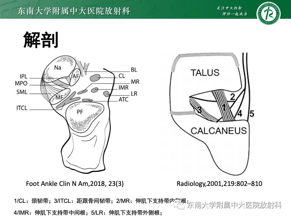 影像PPT - 【PPT】跗骨窦综合征-14