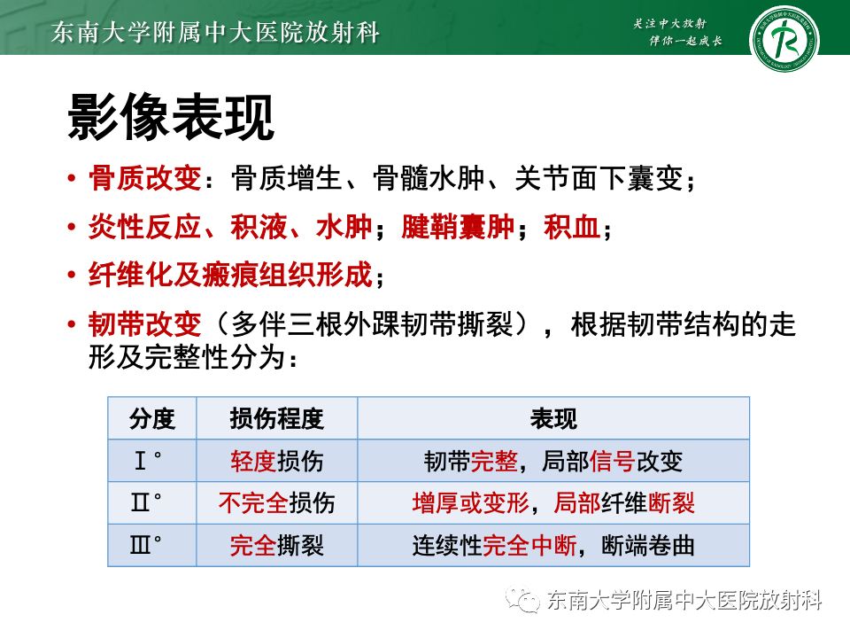 影像PPT - 【PPT】跗骨窦综合征-21