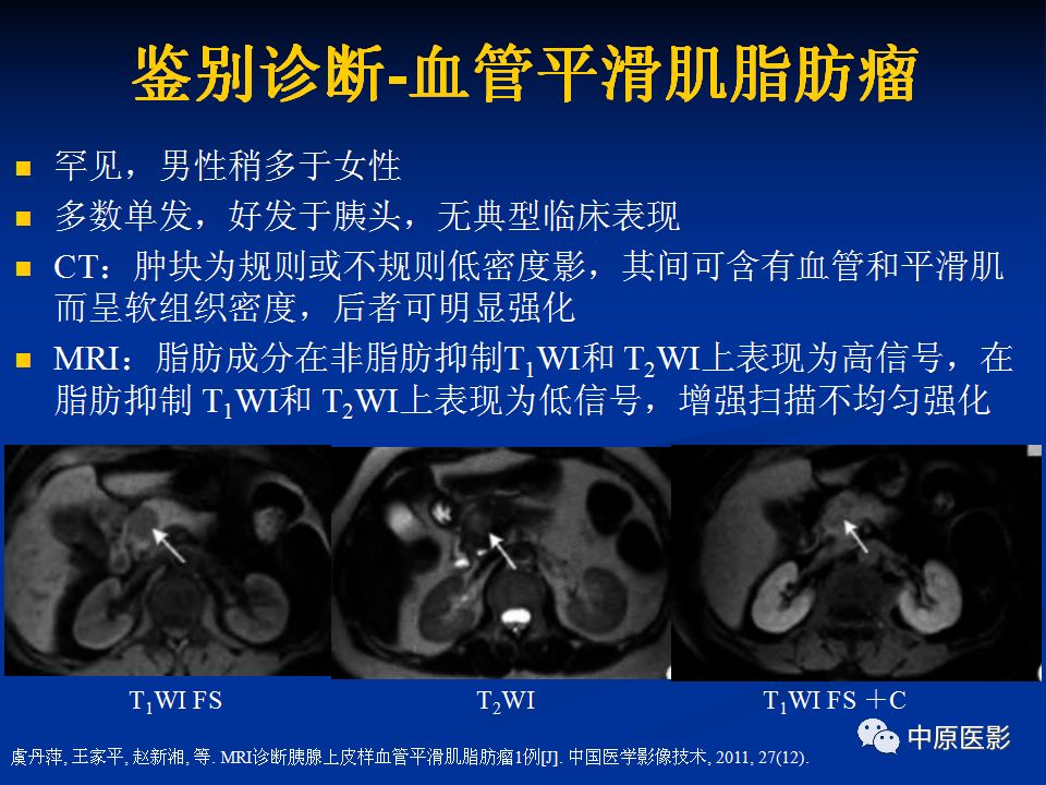 影像PPT - 【病例】胰腺局灶性脂肪浸润1例CT及MR-20