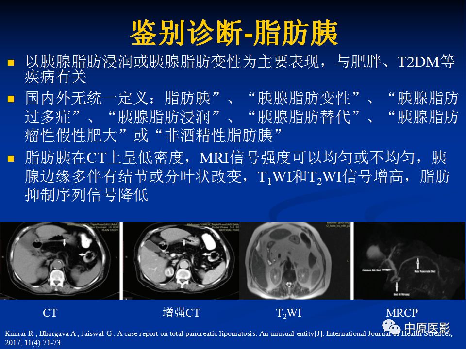影像PPT - 【病例】胰腺局灶性脂肪浸润1例CT及MR-21