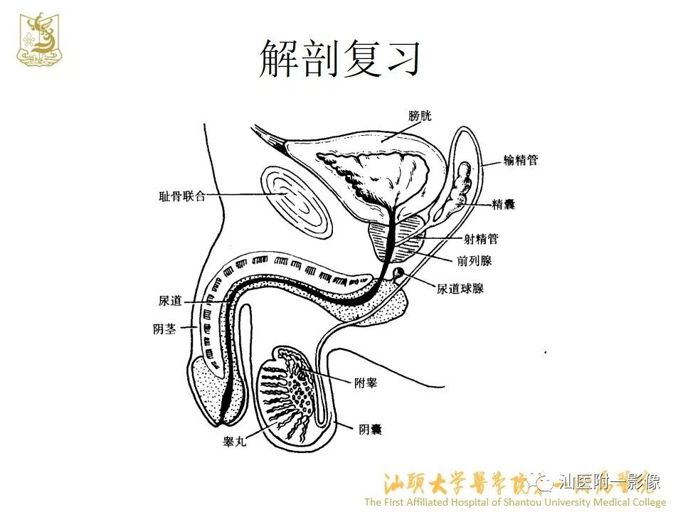 影像PPT - 【PPT】前列腺囊肿的影像诊断-4