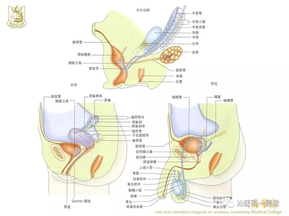 影像PPT - 【PPT】前列腺囊肿的影像诊断-6