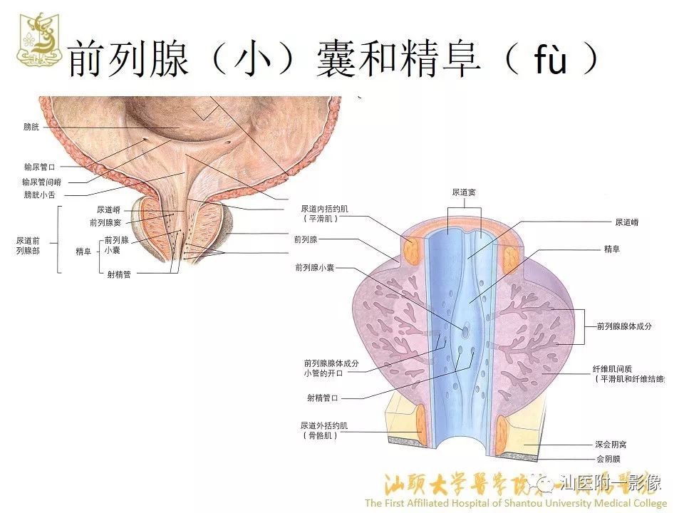 影像PPT - 【PPT】前列腺囊肿的影像诊断-7