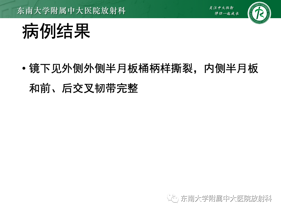 影像PPT - 【PPT】膝关节半月板解剖及常见诊断误区-2