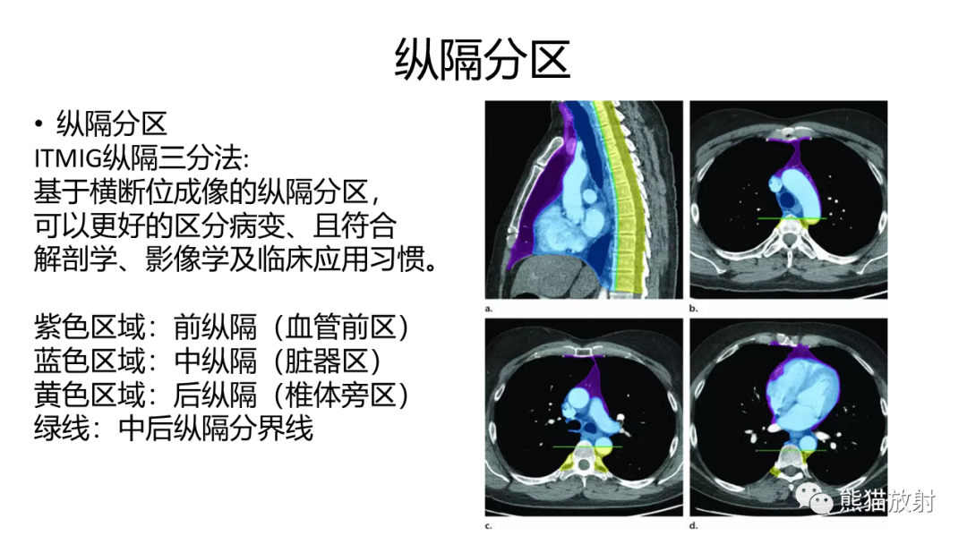 影像PPT - 【病例】纵隔淋巴瘤 VS 胸腺癌-21