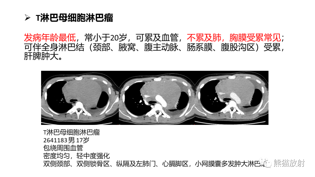 影像PPT - 【病例】纵隔淋巴瘤 VS 胸腺癌-27