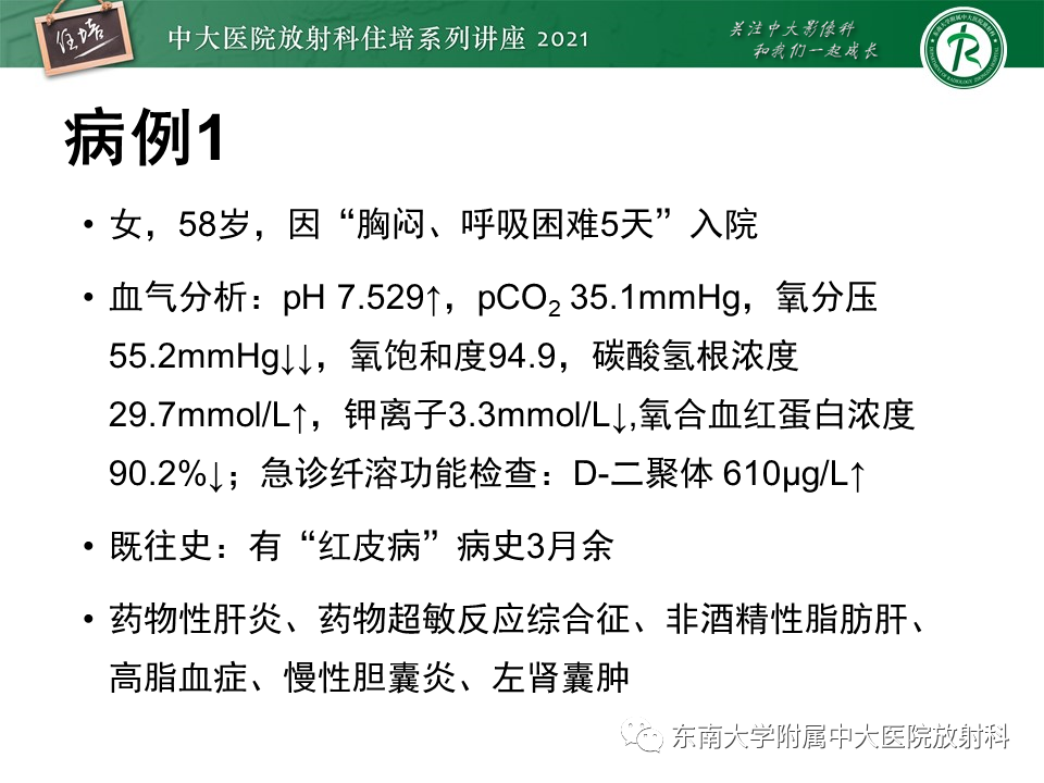 影像PPT - 【PPT】肺孢子菌肺炎-2