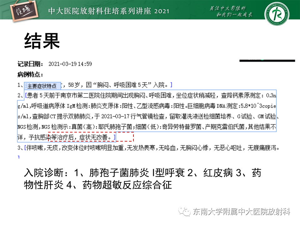 影像PPT - 【PPT】肺孢子菌肺炎-5