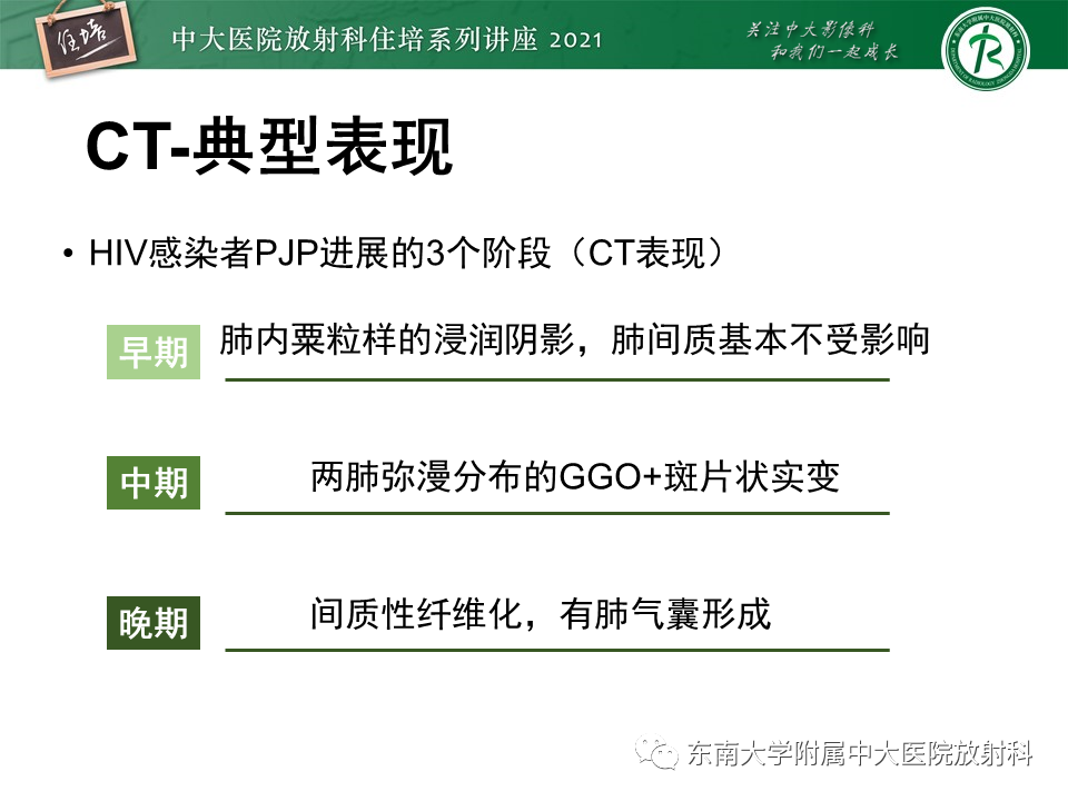 影像PPT - 【PPT】肺孢子菌肺炎-20
