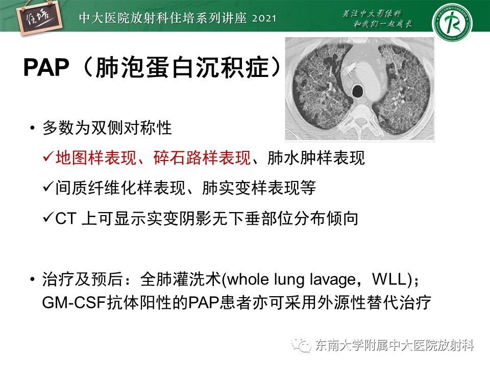 影像PPT - 【PPT】肺孢子菌肺炎-40