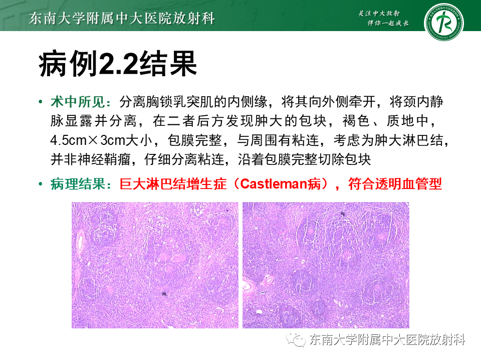 影像PPT - -13 影像PPT - -13