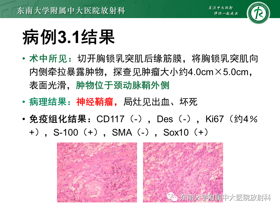 影像PPT - -14 影像PPT - -14