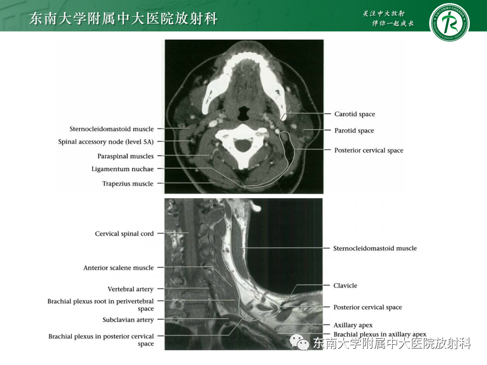 影像PPT - -22 影像PPT - -22