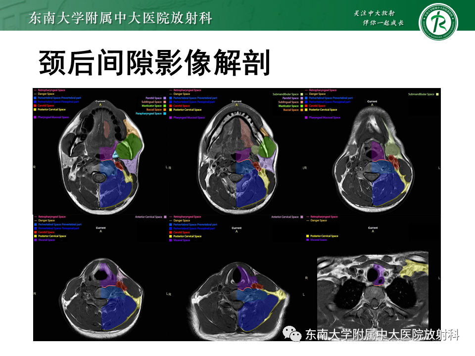 影像PPT - -21 影像PPT - -21