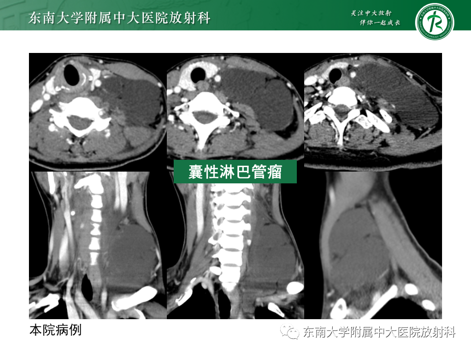 影像PPT - -25 影像PPT - -25