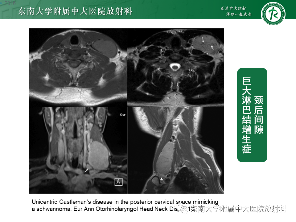 影像PPT - -31 影像PPT - -31