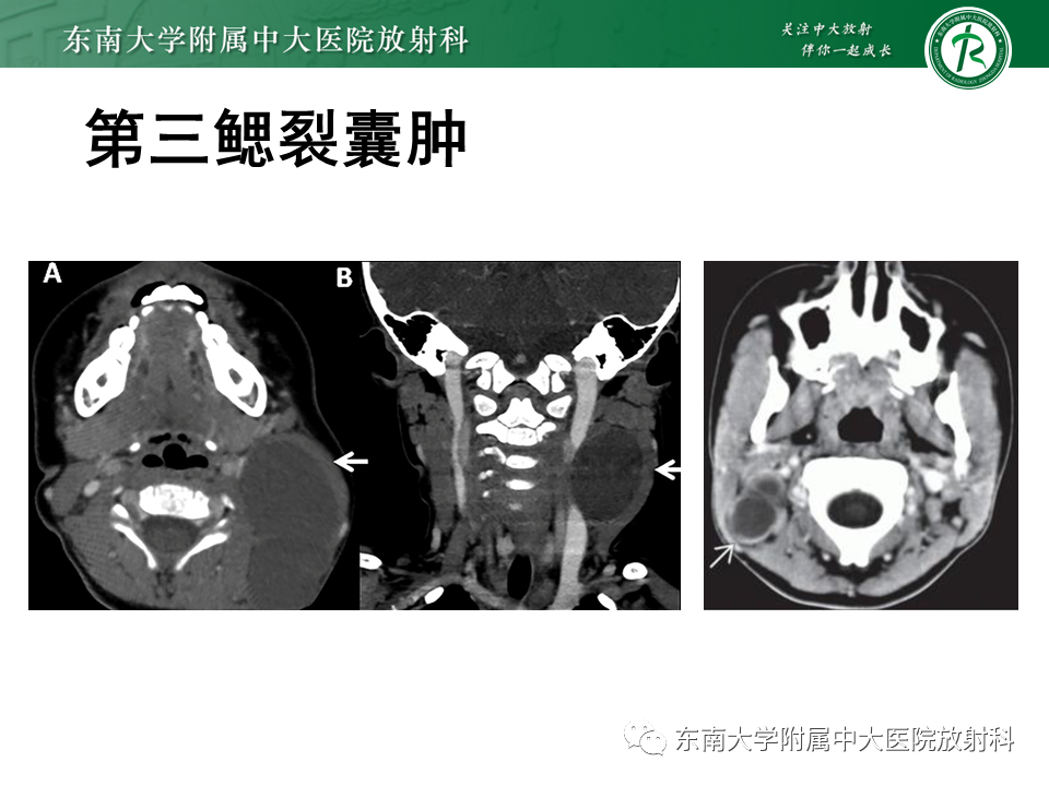 影像PPT - -27 影像PPT - -27