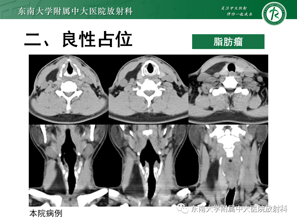 影像PPT - -32 影像PPT - -32
