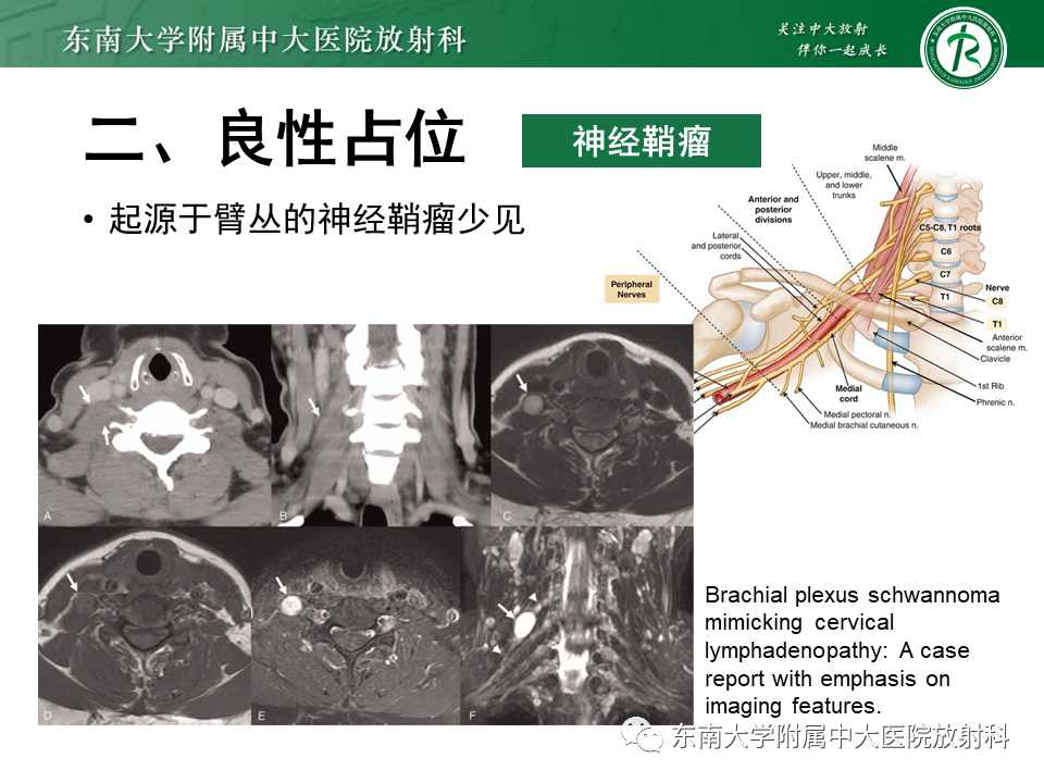 影像PPT - -34 影像PPT - -34