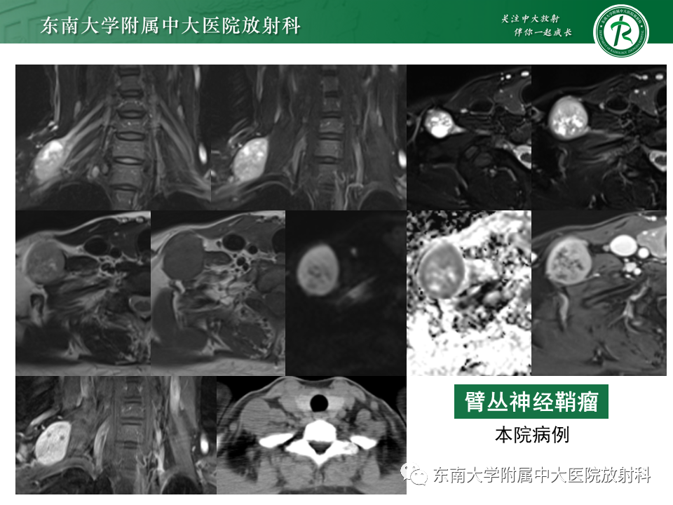 影像PPT - -35 影像PPT - -35