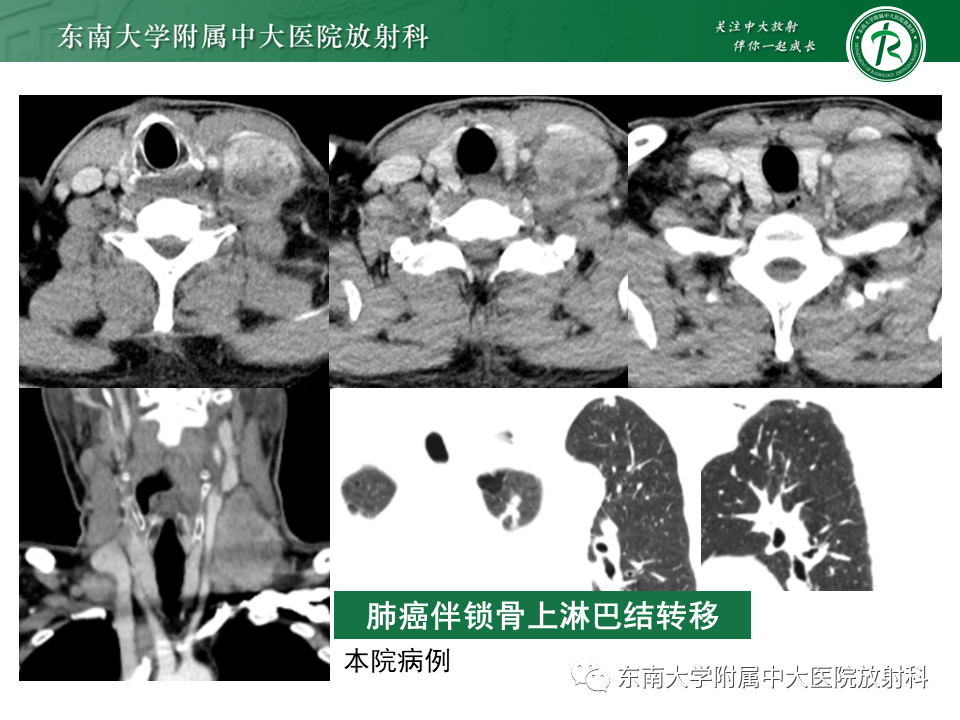影像PPT - -38 影像PPT - -38