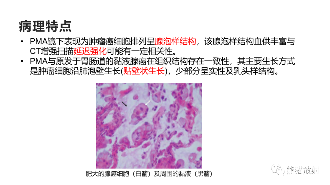 影像PPT - 【病例】肺黏液腺癌2例CT影像-24