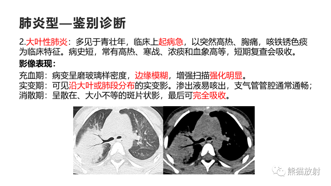 影像PPT - 【病例】肺黏液腺癌2例CT影像-38