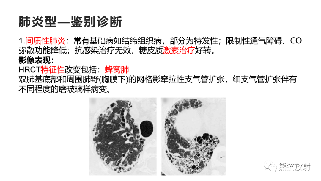 影像PPT - 【病例】肺黏液腺癌2例CT影像-37