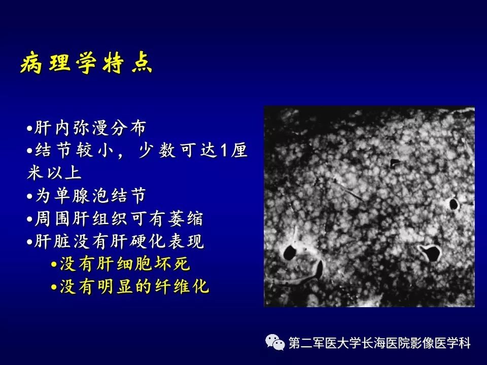 影像PPT - 肝细胞性结节的病理特点及影像诊断-6