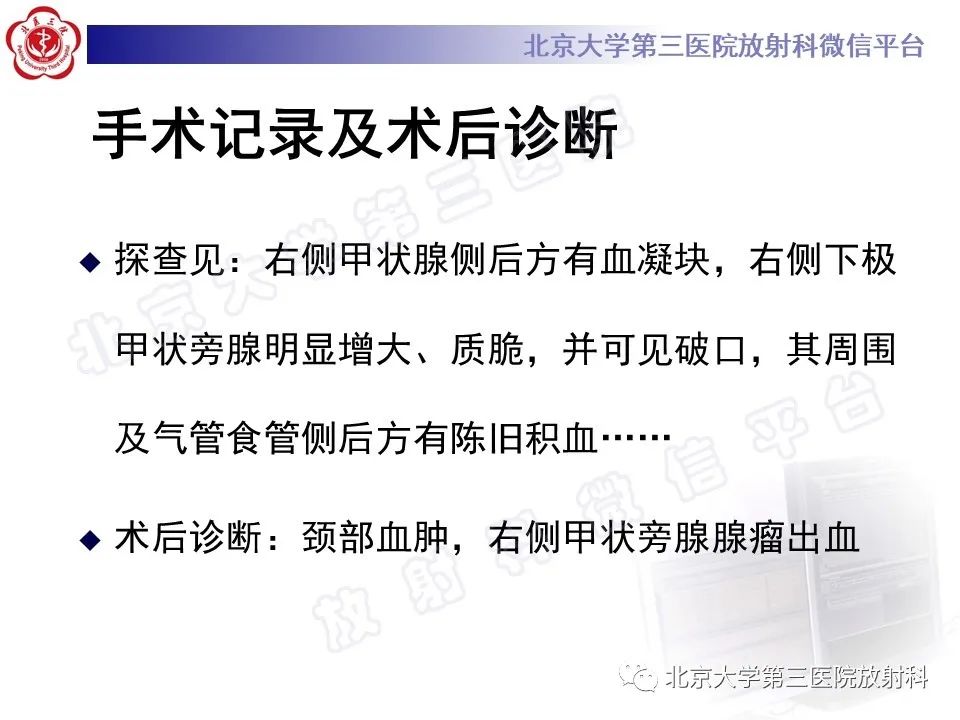 影像PPT - 【PPT】甲状旁腺腺瘤自发破裂-16