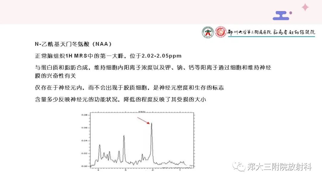 影像PPT - 【PPT】波谱在中枢神经系统的临床应用-4