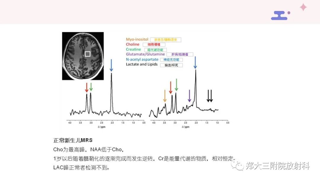 影像PPT - 【PPT】波谱在中枢神经系统的临床应用-11
