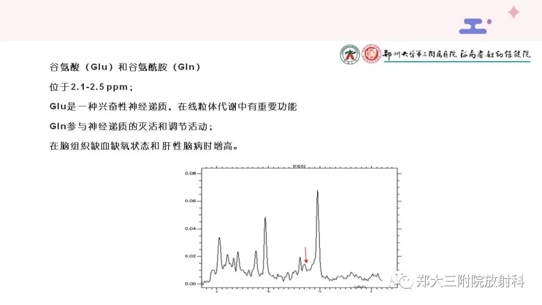 影像PPT - 【PPT】波谱在中枢神经系统的临床应用-10