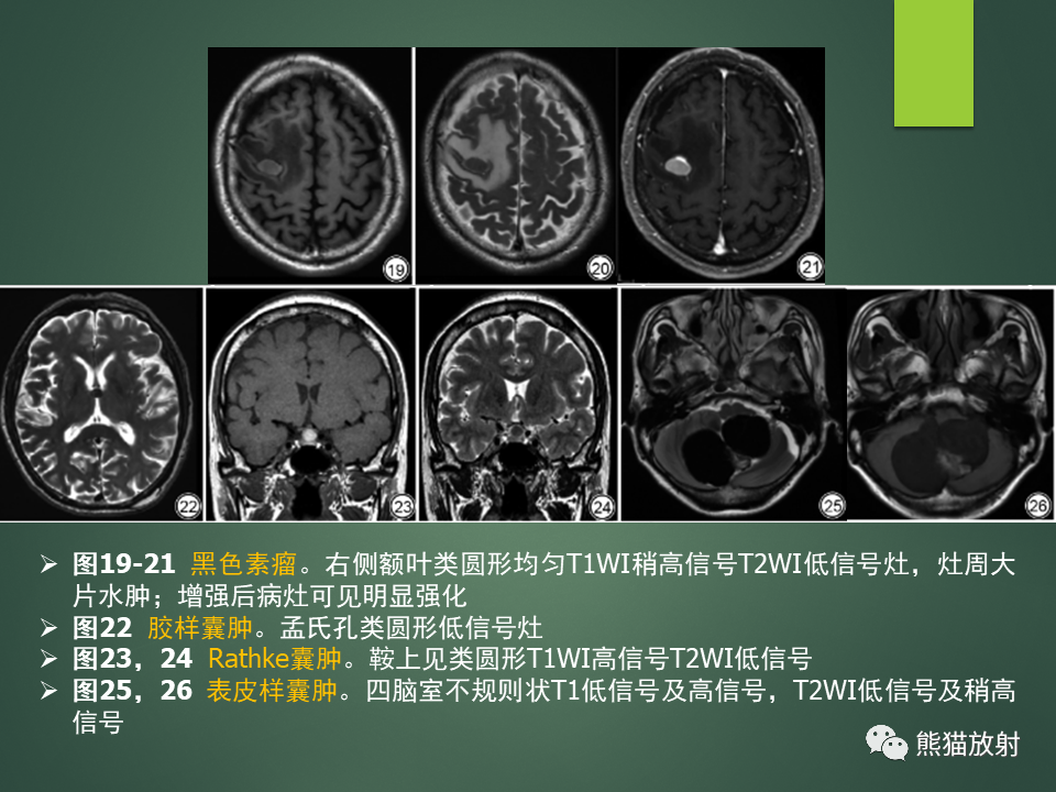 影像PPT - 【PPT】颅内T2WI低信号疾病诊断思路分析-20