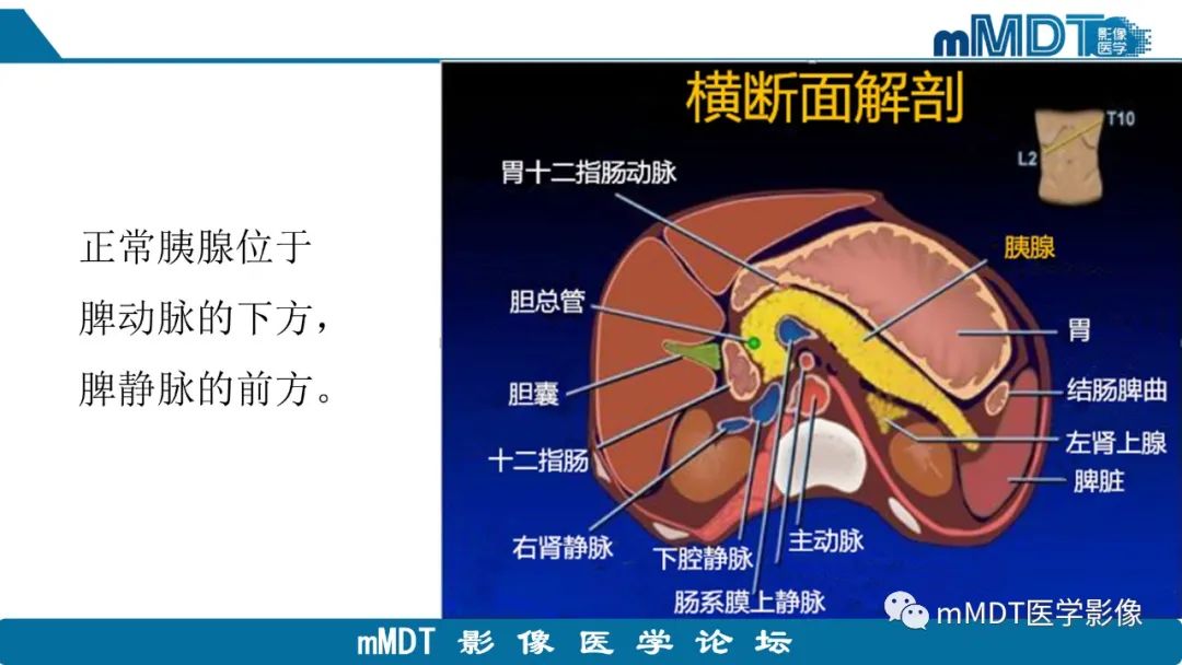 影像PPT - 【PPT】胰腺神经内分泌瘤分级影像对照及鉴别诊断-2 影像PPT - 【PPT】胰腺神经内分泌瘤分级影像对照及鉴别诊断-2
