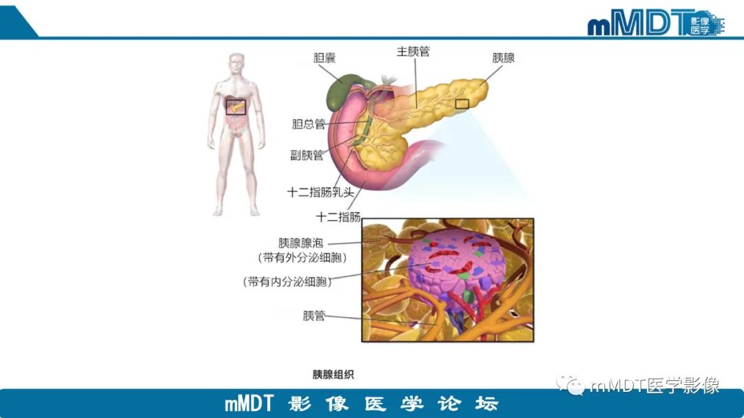 影像PPT - 【PPT】胰腺神经内分泌瘤分级影像对照及鉴别诊断-3 影像PPT - 【PPT】胰腺神经内分泌瘤分级影像对照及鉴别诊断-3