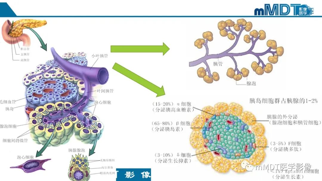 影像PPT - 【PPT】胰腺神经内分泌瘤分级影像对照及鉴别诊断-5 影像PPT - 【PPT】胰腺神经内分泌瘤分级影像对照及鉴别诊断-5