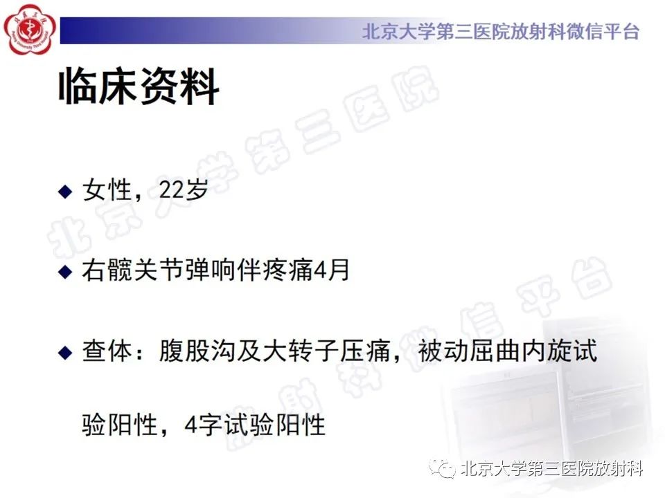 影像PPT - 【PPT】髋臼唇撕裂-2