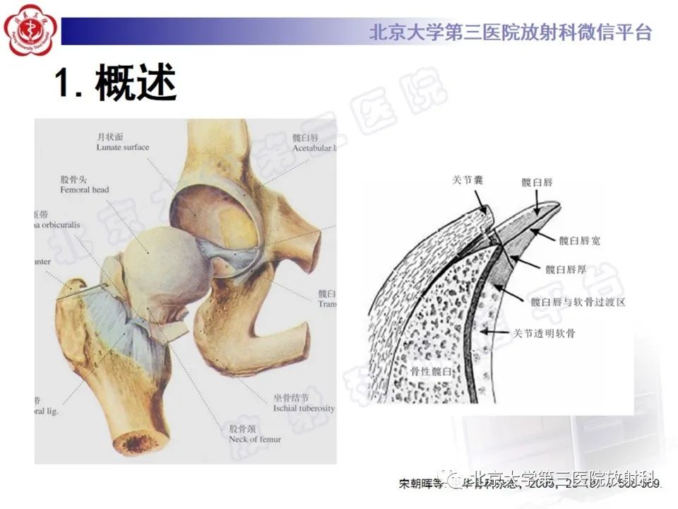 影像PPT - 【PPT】髋臼唇撕裂-8