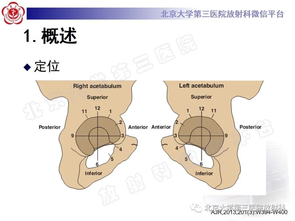 影像PPT - 【PPT】髋臼唇撕裂-10