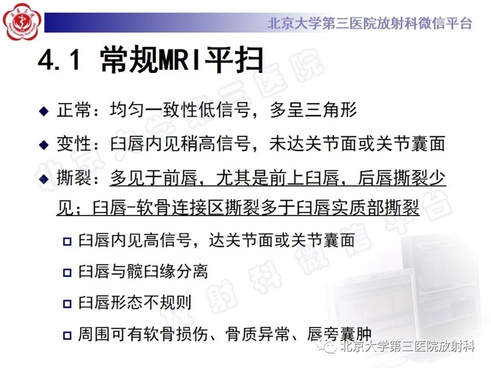 影像PPT - 【PPT】髋臼唇撕裂-17
