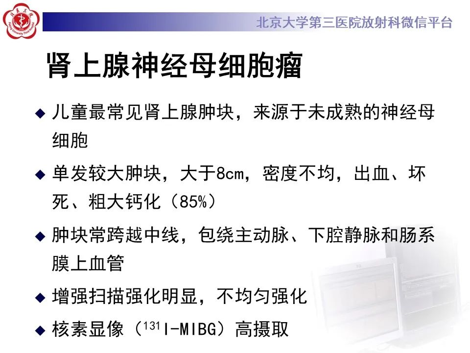 影像PPT - 【PPT】肾上腺原始神经外胚层肿瘤-29